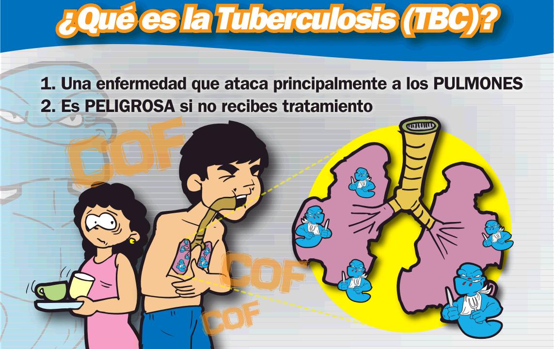 tuberculosis 1