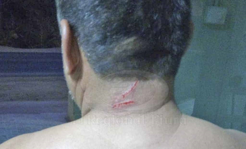 Apolonio Rivas Silva (42) fue agredido por conviviente
