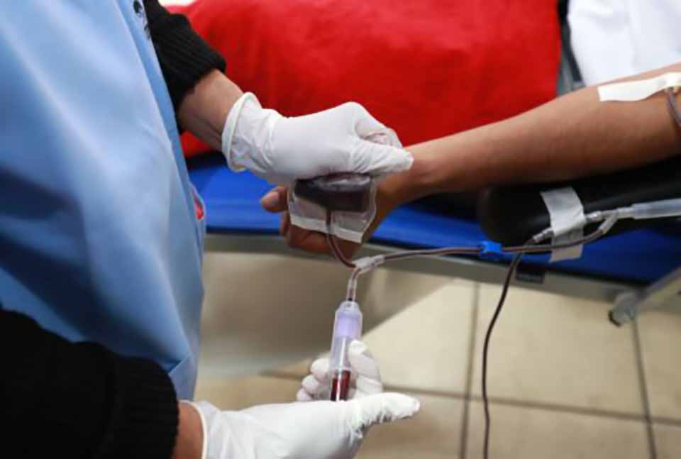 guillain barre b